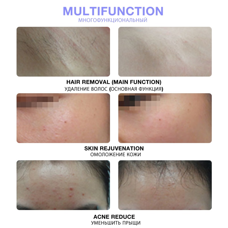 Épilateur Laser indolore à écran LCD, photoépilation permanente, 2020 000 flashs, sans douleur, IPL, nouveauté 999999