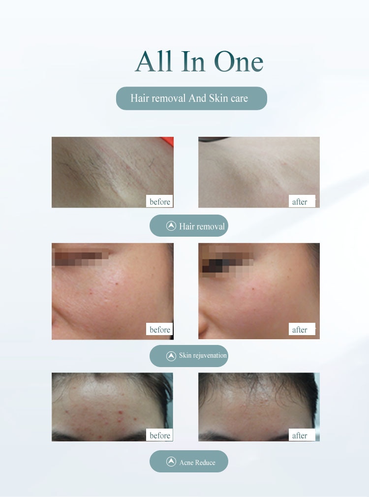 Épilateur Laser indolore à écran LCD, photoépilation permanente, 2020 000 flashs, sans douleur, IPL, nouveauté 999999