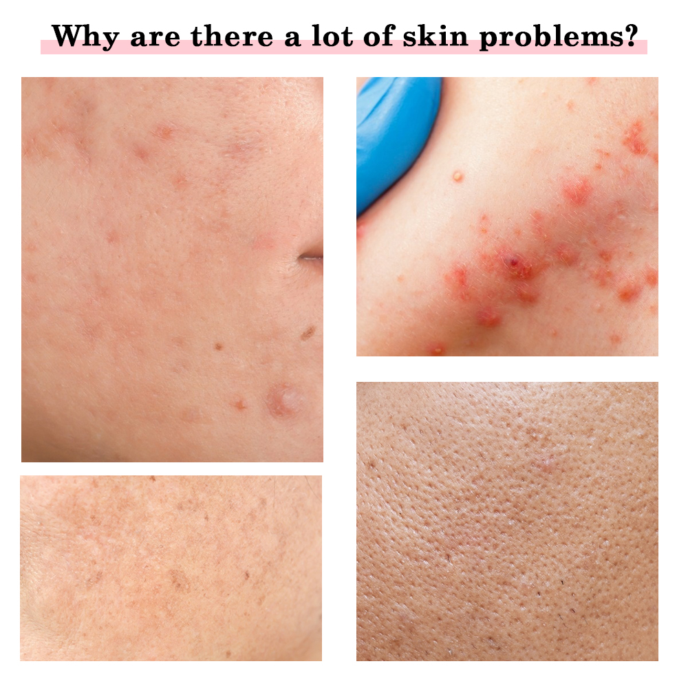 Appareil de Massage Facial